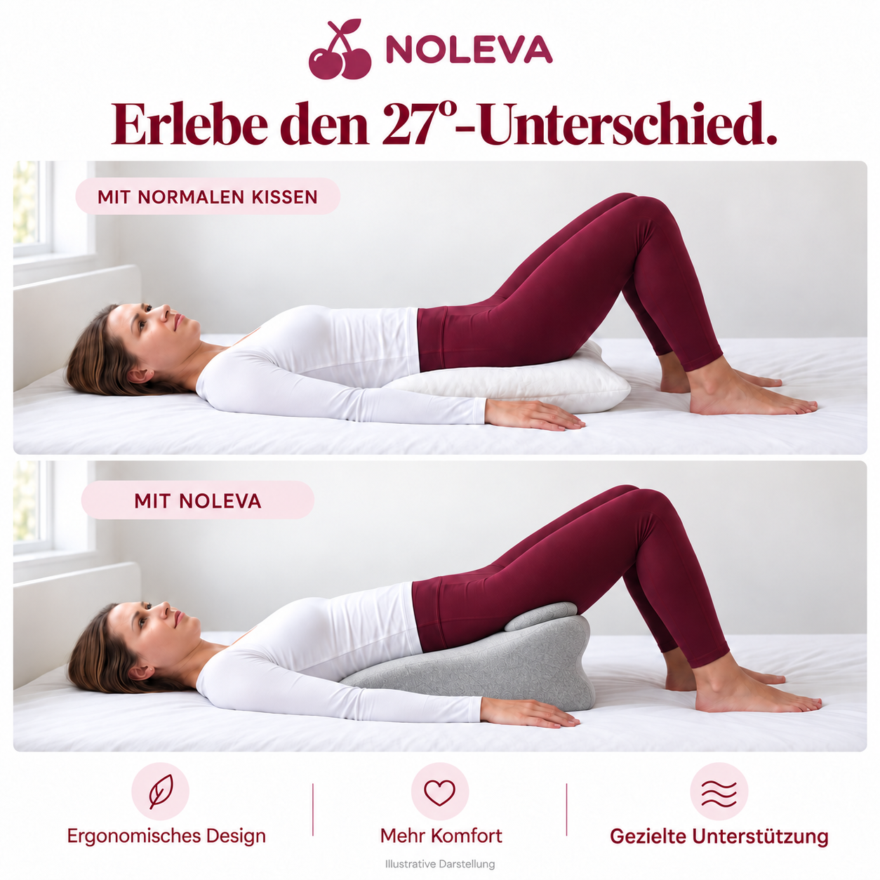 NOLEVA®